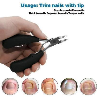 ONLY 50%OFF TODAY -  Nail Clippers for Thick or Ingrown nails - BestBck